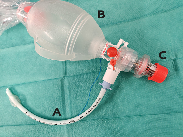 Foto som visar endotrakealtub (A) kopplad till AMBU-blåsa (B) med PEEP-ventil (C)