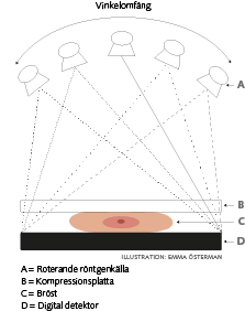 Illustration över brösttomosyntes