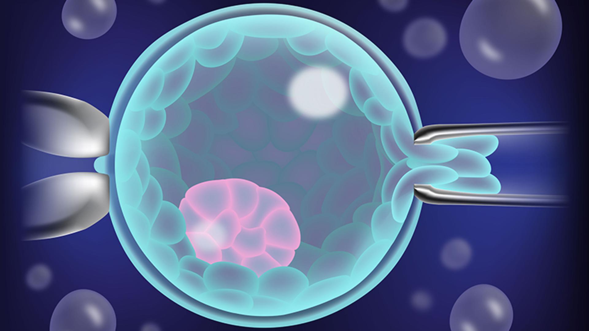 Embryo i blastocyststadiet, biopsi görs på embryot för att utföra preimplantatorisk genetisk testning