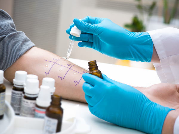 Pricktest för att ta reda på allergi