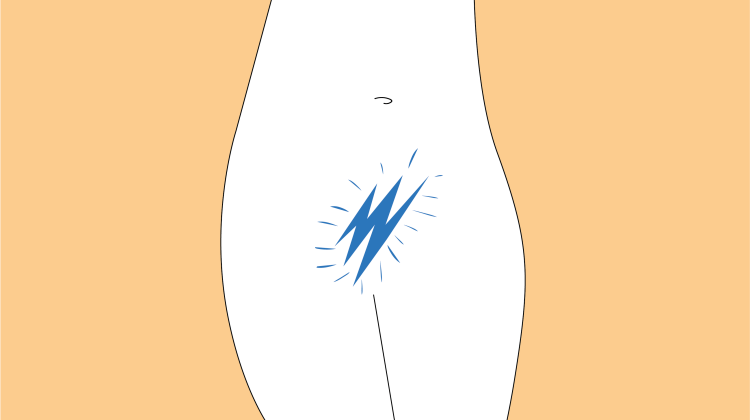 Illustration som visar smärtan på en ung kvinna vid vulvodyni (vestibulit)