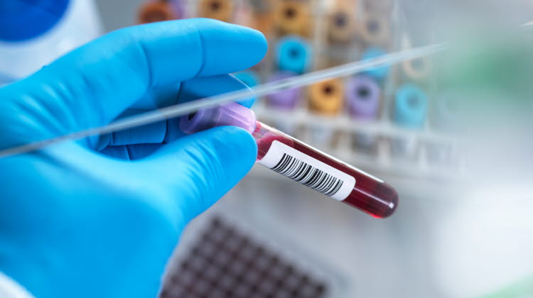 Laboratoriepersonal som håller i ett blodprov