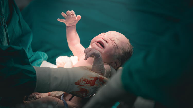 Kejsarsnitt. Läkare och sjuksköterska tar ut en nyfödd bebis från mammas mage.
