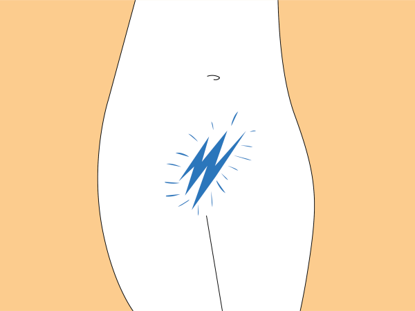 Illustration som visar smärtan på en ung kvinna vid vulvodyni (vestibulit)